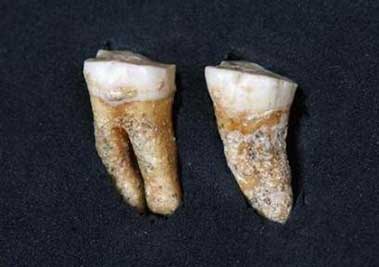 Apparently, Neanderthal humans had better oral hygiene 63,000 years ago than many people in today’s society…